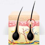 chute de cheveux - explication